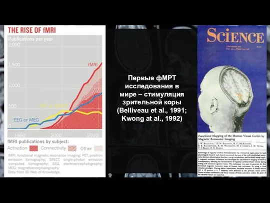 Первые фМРТ исследования в мире – стимуляция зрительной коры (Belliveau et