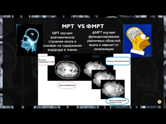 МРТ VS ФМРТ МРТ изучает анатомическое строение мозга и основан на