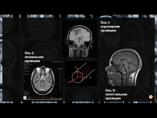Ось Z: аксиальная проекция Ось Y: коронарная проекция Ось Х: сагиттальная проекция