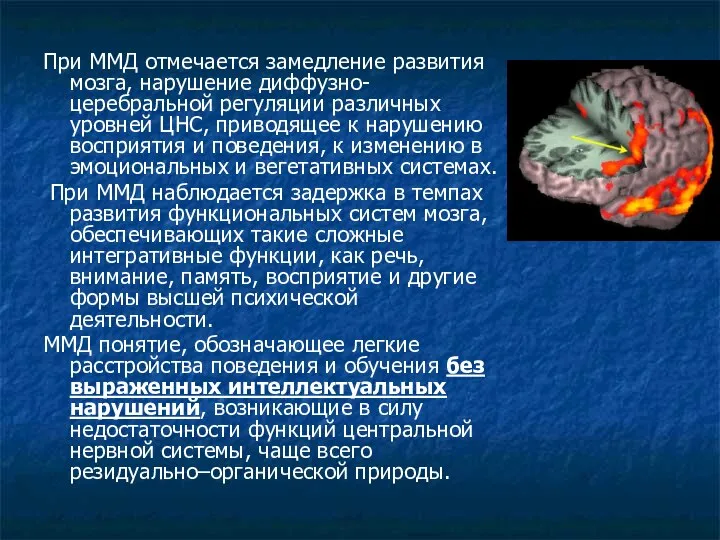 При ММД отмечается замедление развития мозга, нарушение диффузно-церебральной регуляции различных уровней