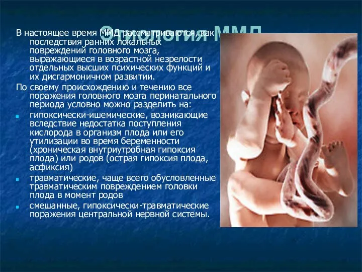 Этиология ММД В настоящее время ММД рассматриваются, как последствия ранних локальных