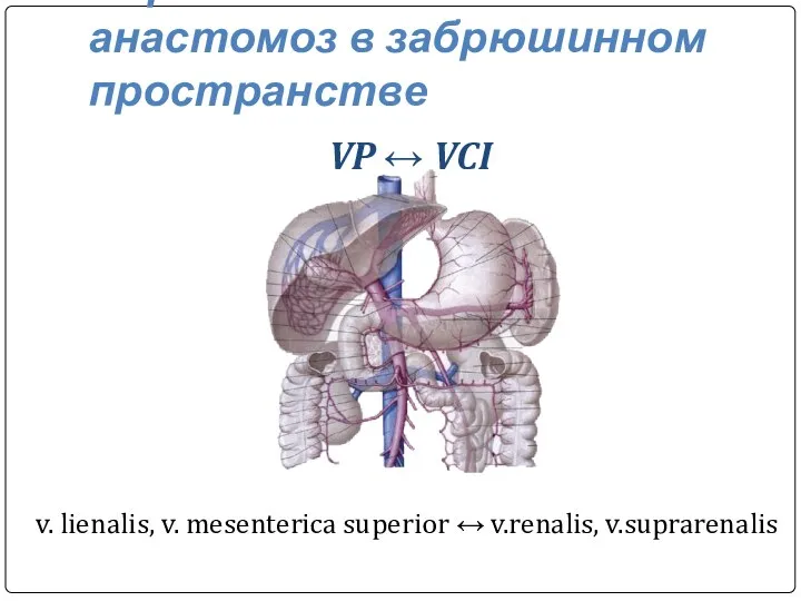 Порто-кавальный анастомоз в забрюшинном пространстве VP ↔ VCI v. lienalis, v. mesenterica superior ↔ v.renalis, v.suprarenalis