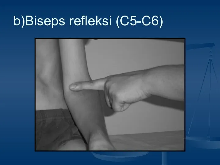 b)Biseps refleksi (C5-C6)