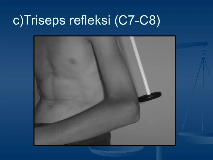 c)Triseps refleksi (C7-C8)