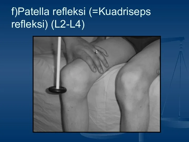 f)Patella refleksi (=Kuadriseps refleksi) (L2-L4)