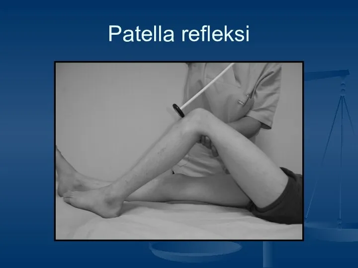 Patella refleksi