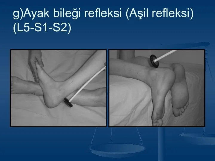 g)Ayak bileği refleksi (Aşil refleksi) (L5-S1-S2)