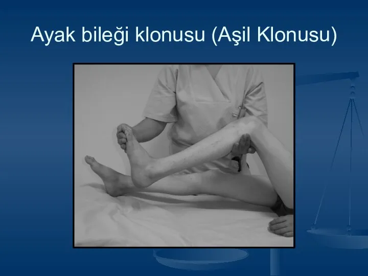 Ayak bileği klonusu (Aşil Klonusu)