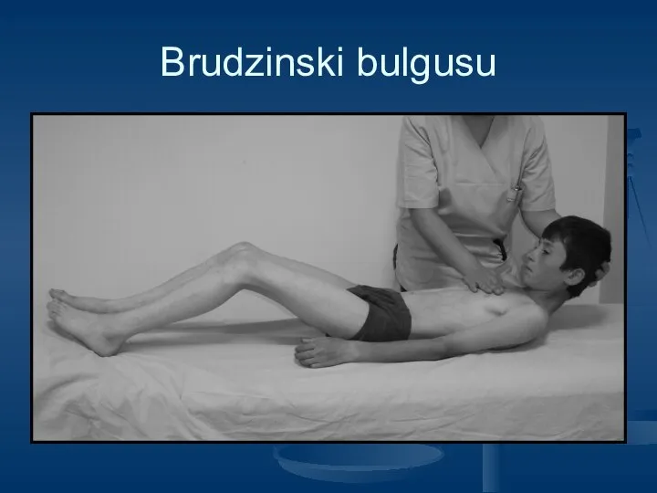 Brudzinski bulgusu