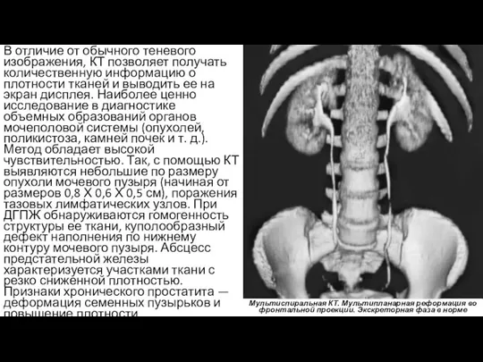 В отличие от обычного теневого изображения, КТ позволяет получать количественную информацию