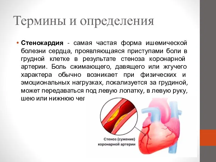 Термины и определения Стенокардия - самая частая форма ишемической болезни сердца,