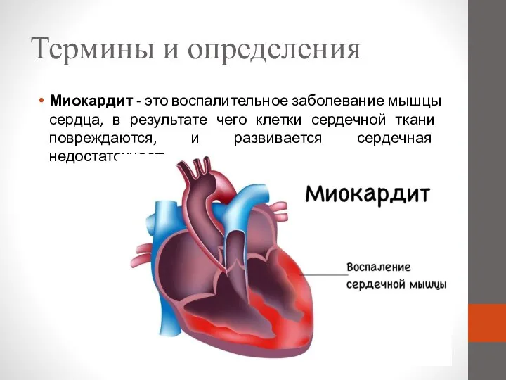 Термины и определения Миокардит - это воспалительное заболевание мышцы сердца, в