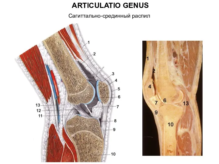 ARTICULATIO GENUS Сагиттально-срединный распил