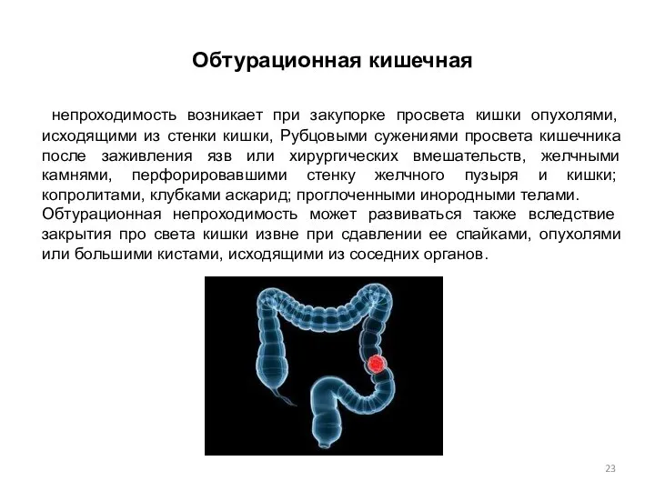 Обтурационная кишечная непроходимость возникает при закупорке просвета кишки опухолями, исходящими из