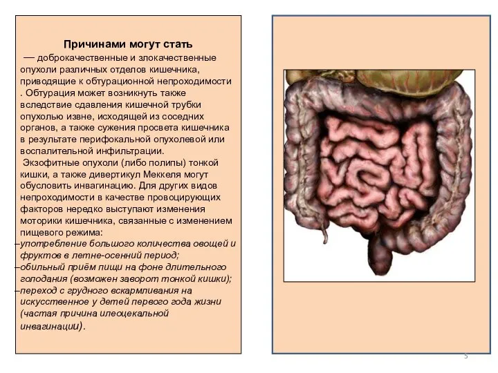 Причинами могут стать — доброкачественные и злокачественные опухоли различных отделов кишечника,