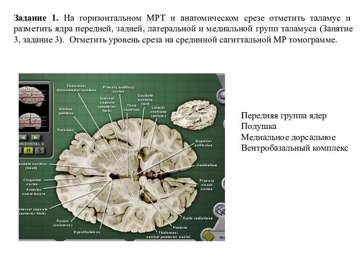 Передняя группа ядер Подушка Медиальное дорсальное Вентробазальный комплекс Задание 1. На