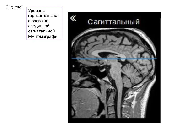 Задание1 Уровень горизонтального среза на срединной сагиттальной МР томографе