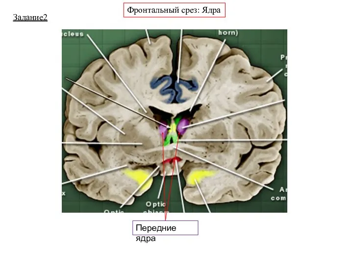 Задание2 Фронтальный срез: Ядра Передние ядра