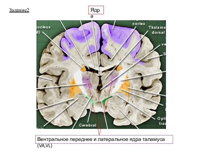 Задание2 Ядра Вентральное переднее и латеральное ядра таламуса (VA,VL)
