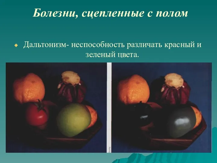 Болезни, сцепленные с полом Дальтонизм- неспособность различать красный и зеленый цвета.