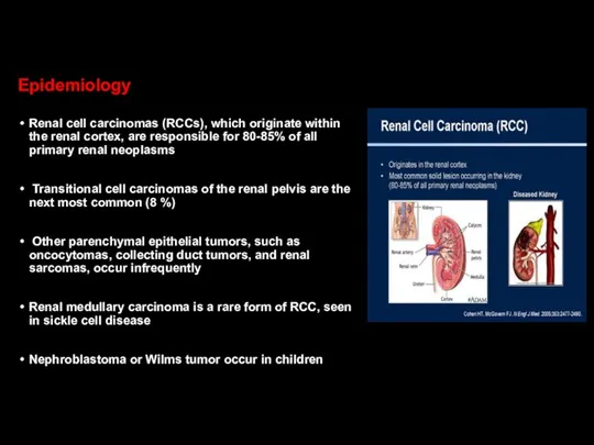 Epidemiology Renal cell carcinomas (RCCs), which originate within the renal cortex,