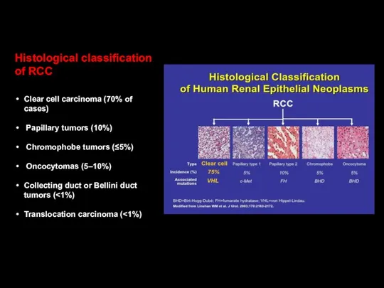 Histological classification of RCC Clear cell carcinoma (70% of cases) Papillary