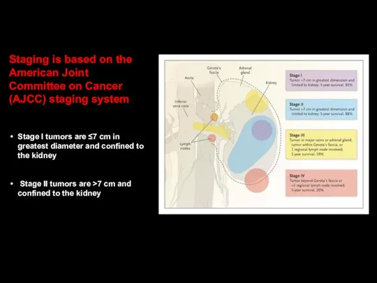 Staging is based on the American Joint Committee on Cancer (AJCC)