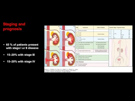 Staging and prognosis 65 % of patients present with stage I