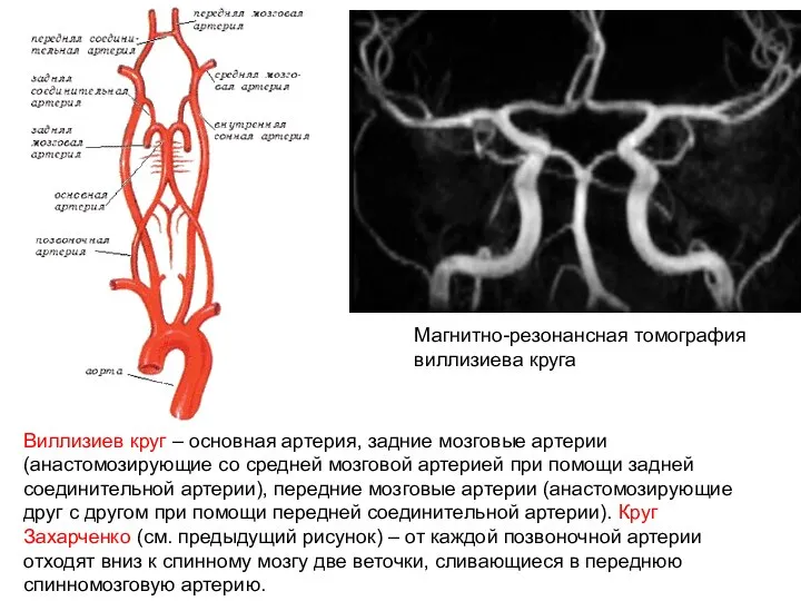 Магнитно-резонансная томография виллизиева круга Виллизиев круг – основная артерия, задние мозговые