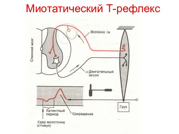 Миотатический Т-рефлекс