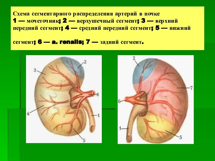 Схема сегментарного распределения артерий в почке 1 — мочеточник; 2 —