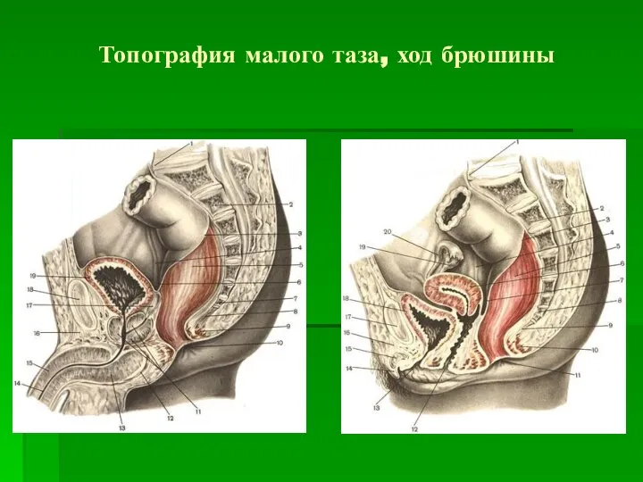 Топография малого таза, ход брюшины