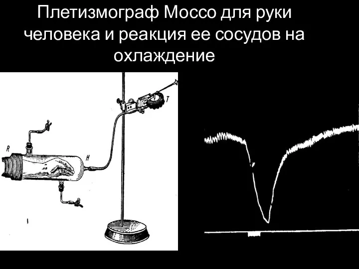 Плетизмограф Моссо для руки человека и реакция ее сосудов на охлаждение укол