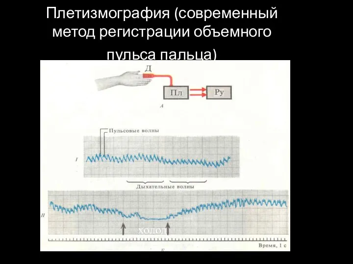 Плетизмография (современный метод регистрации объемного пульса пальца) холод