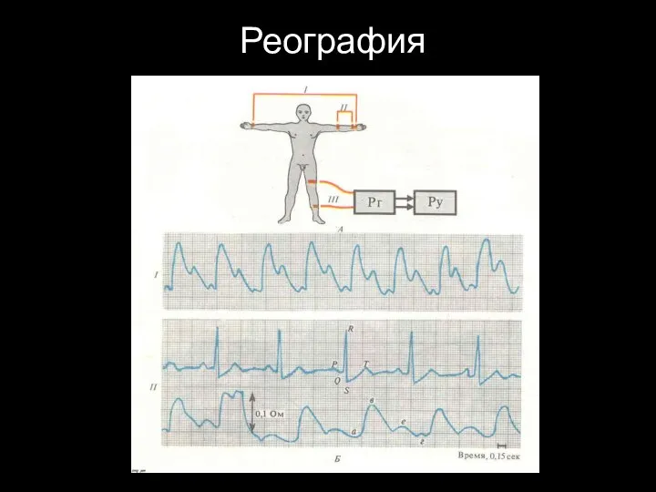 Реография