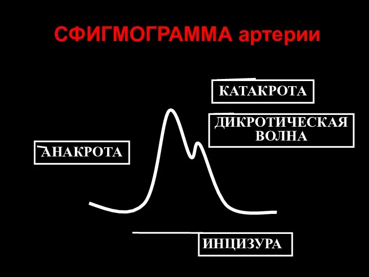 СФИГМОГРАММА артерии АНАКРОТА КАТАКРОТА ДИКРОТИЧЕСКАЯ ВОЛНА ИНЦИЗУРА