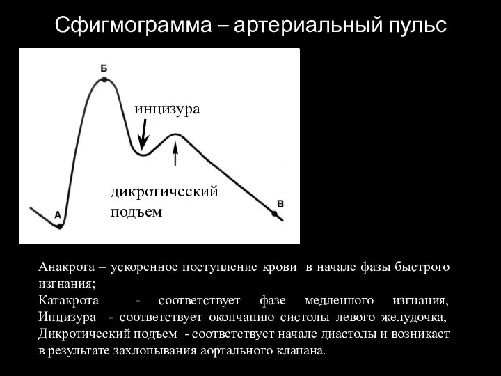 Сфигмограмма – артериальный пульс инцизура дикротический подъем Анакрота – ускоренное поступление