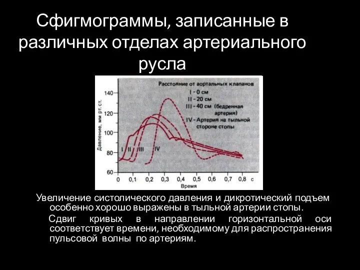 Сфигмограммы, записанные в различных отделах артериального русла Увеличение систолического давления и