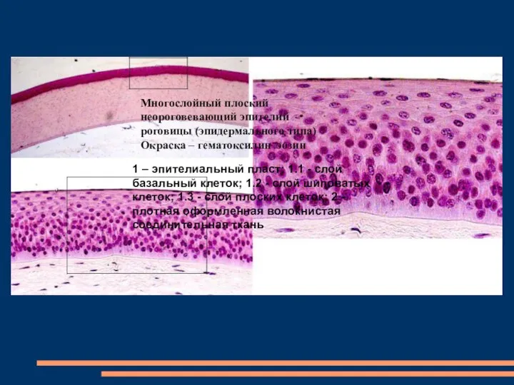 Многослойный плоский неороговевающий эпителий роговицы (эпидермального типа) Окраска – гематоксилин–эозин 1