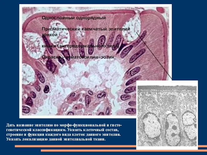 Дать название эпителию по морфо-функциональной и гисто-генетической классификациям. Указать клеточный состав,