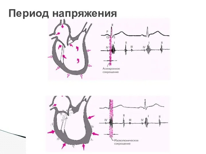 Период напряжения