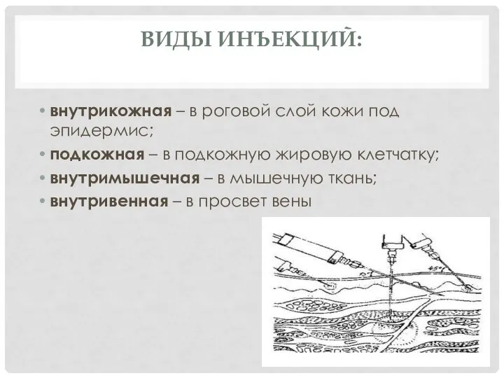 ВИДЫ ИНЪЕКЦИЙ: внутрикожная – в роговой слой кожи под эпидермис; подкожная