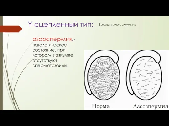 азооспермия.-патологическое состояние, при котором в эякуляте отсутствуют сперматозоиды Y-сцепленный тип: Болеют только мужчины