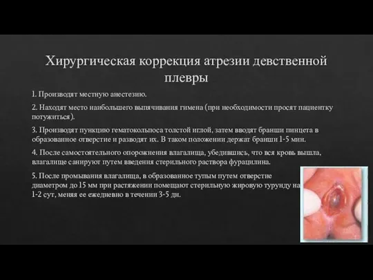 Хирургическая коррекция атрезии девственной плевры 1. Производят местную анестезию. 2. Находят