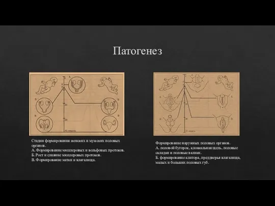 Патогенез Формирование наружных половых органов. А. половой бугорок, клоакальная щель, половые