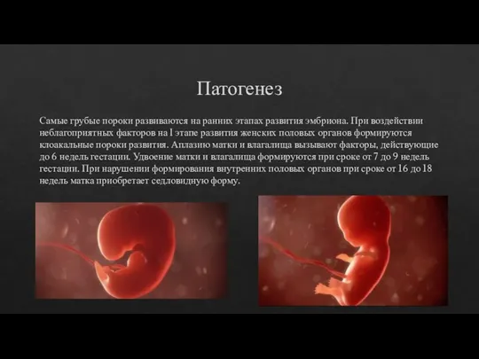 Патогенез Самые грубые пороки развиваются на ранних этапах развития эмбриона. При