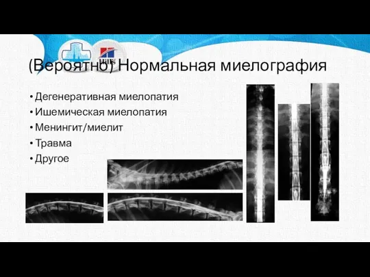 (Вероятно) Нормальная миелография Дегенеративная миелопатия Ишемическая миелопатия Менингит/миелит Травма Другое