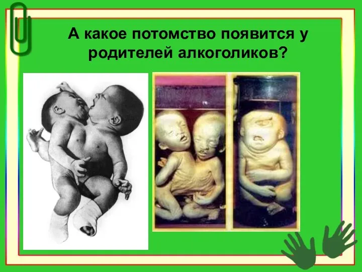 А какое потомство появится у родителей алкоголиков?