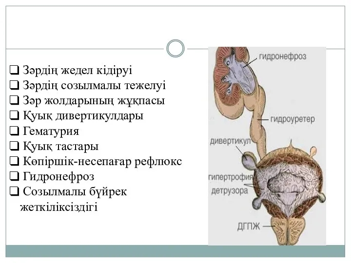 Зәрдің жедел кідіруі Зәрдің созылмалы тежелуі Зәр жолдарының жұқпасы Қуық дивертикулдары