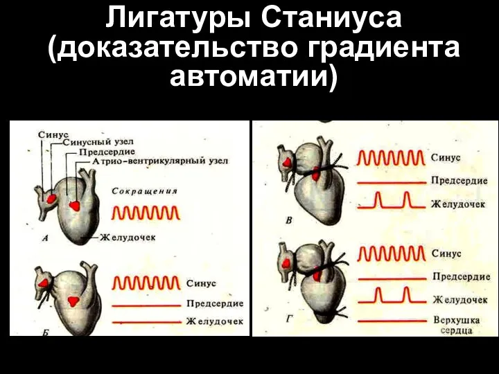 Лигатуры Станиуса (доказательство градиента автоматии)